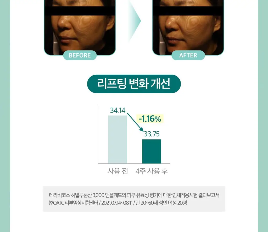 [수분탄력/모공탄력] 테라비코스 히알루론산 3000 앰플 패드 70매 상세페이지 16